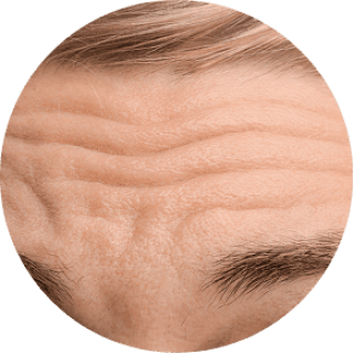 Deep Wrinkles